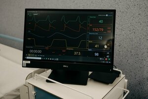 What can be the cause of a churn rate increase in business?