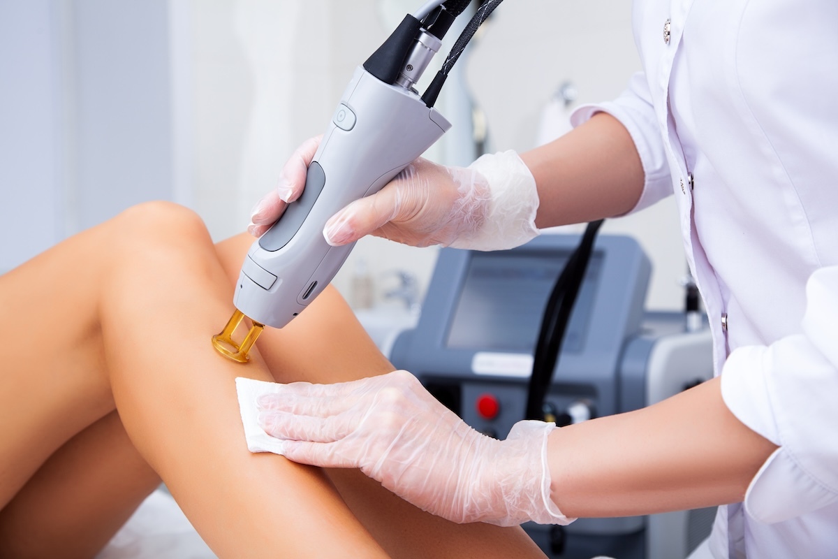 How to Craft Effective Laser Hair Removal Ads for Social Media