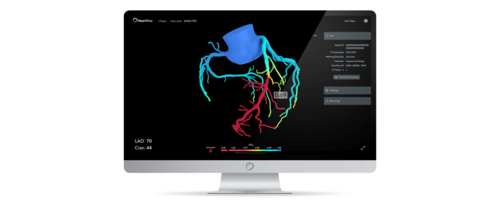 HeartFlow Customer Service Story