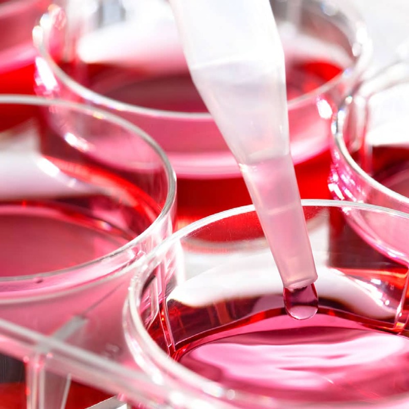 AB Enzymes | SugarCRM UK