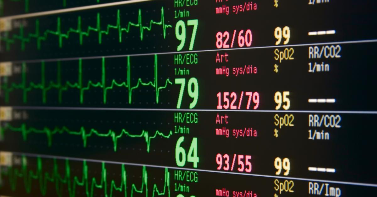 Biometrics and Customer Experience (CX) | UserTesting Blog