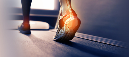 Case Study – Orthofeet - OpenMoves - Digital Marketing Agency NY