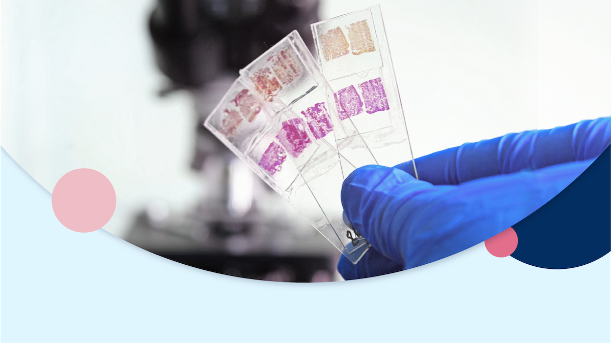 AI at Work: How Salesforce AI Could Make Therapeutic Decision-Making for Breast Cancer More Accurate, Affordable and Accessible